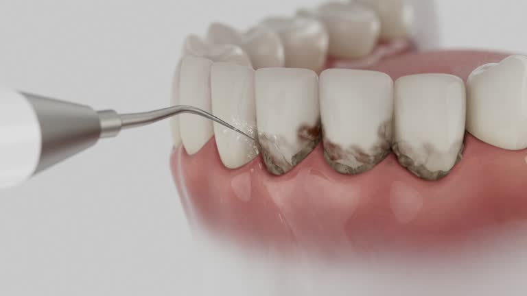 Reliable Dental contractor in Fort Pierce South, FL by Dentist Open Now